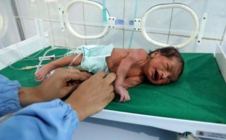 ارتفاع وفيات الولادة المبكرة في اليمن 50% عن المعدل العالمي....