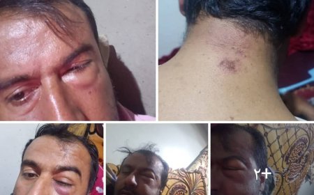 معلم يشكوا تعرضه لاعتداء غادر في الضالع 