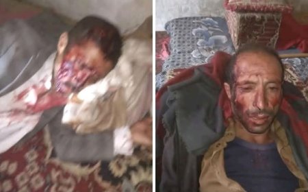 خلال معركة بالفأس..مأساة مؤلمة تهز صنعاء تتسبب بوفيات واصابات (تعرف على تفاصيل الحادثة)