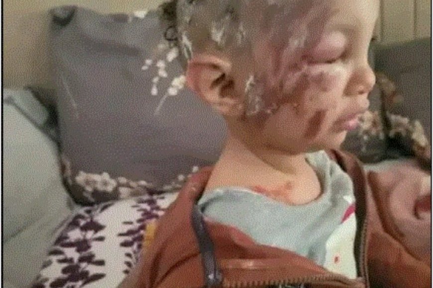 طفل ينجو من هجوم كلاب ضالة في عمران بفضل شجاعة جارة