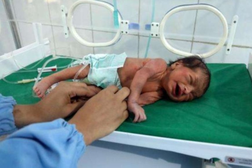 ارتفاع وفيات الولادة المبكرة في اليمن بنسبة 50% عن المعدل العالمي