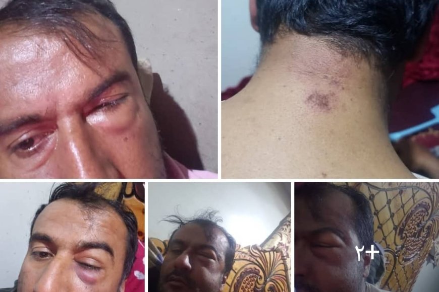 معلم في الضالع يتعرض لاعتداء غادر ويطالب بالتحقيق الفوري