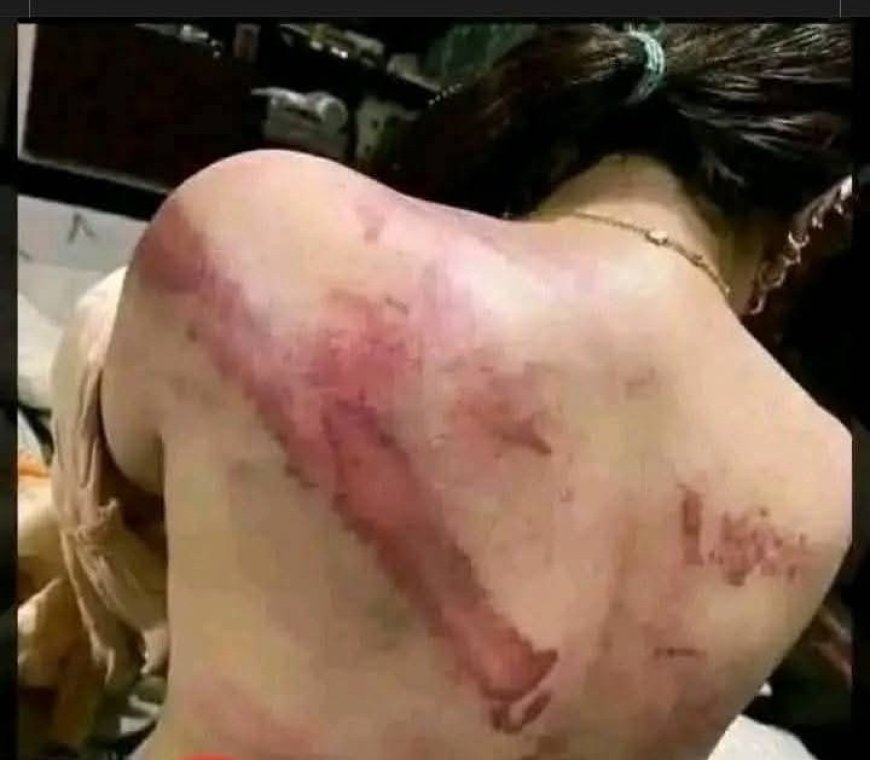 تنديد بمعاناة النساء في سجون الحو...ثيين بصنعاء..