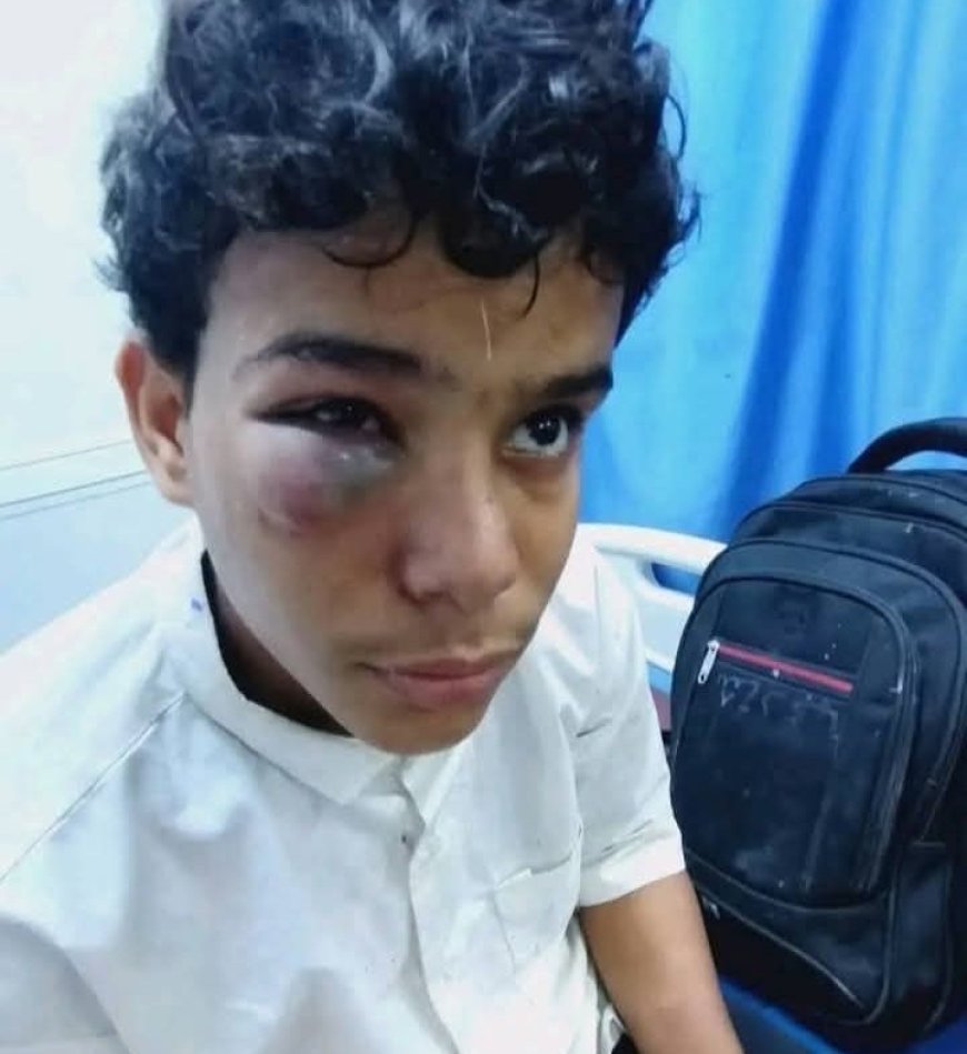 مهاجرون أفارقة يعتدون بوحشية على طفل في حضرموت ...