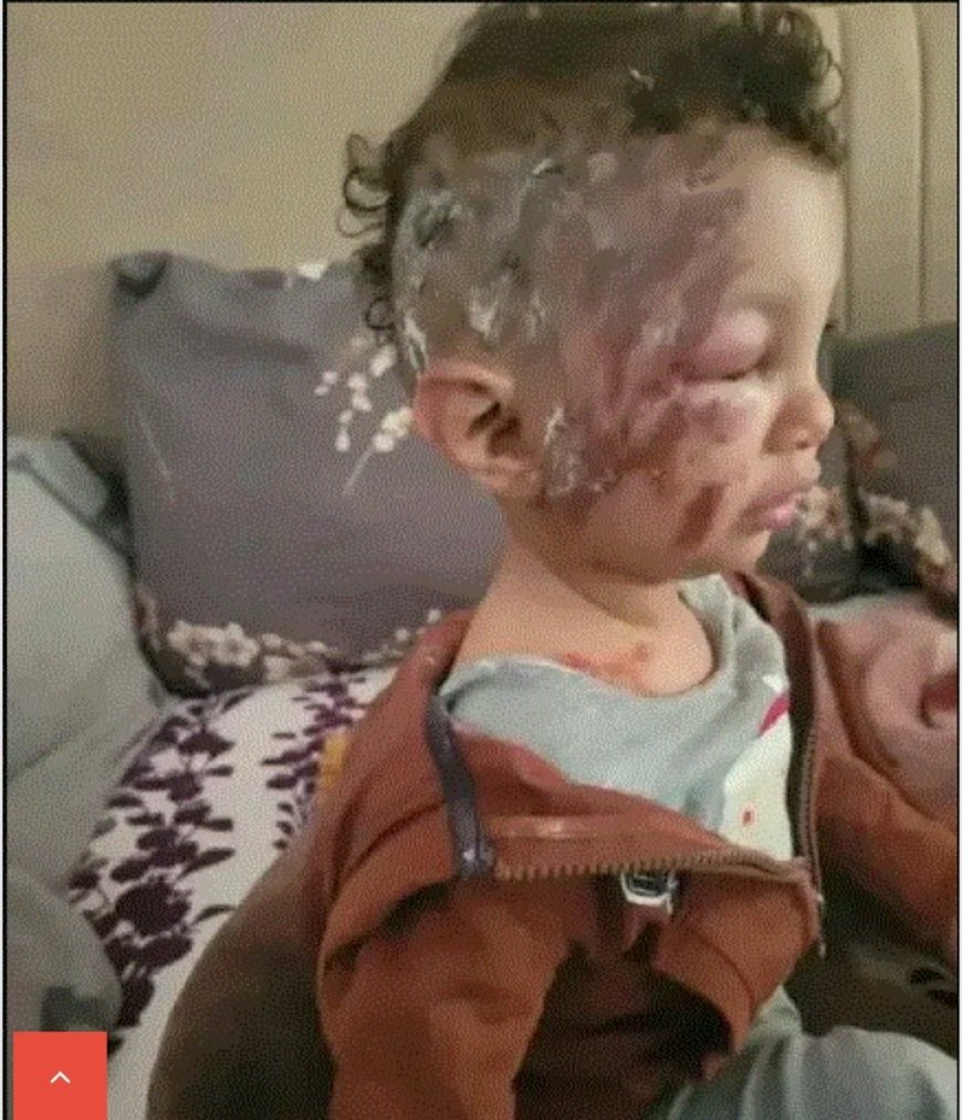 نجاة طفل بأعجوبة من هجوم كلاب ضالة في عمران.....