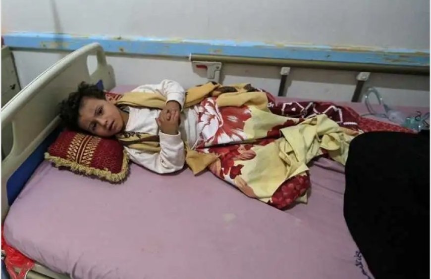 تعز تسجل وفاة 94 حالة وإصابة 14 ألف إصابة بالحصبة ...