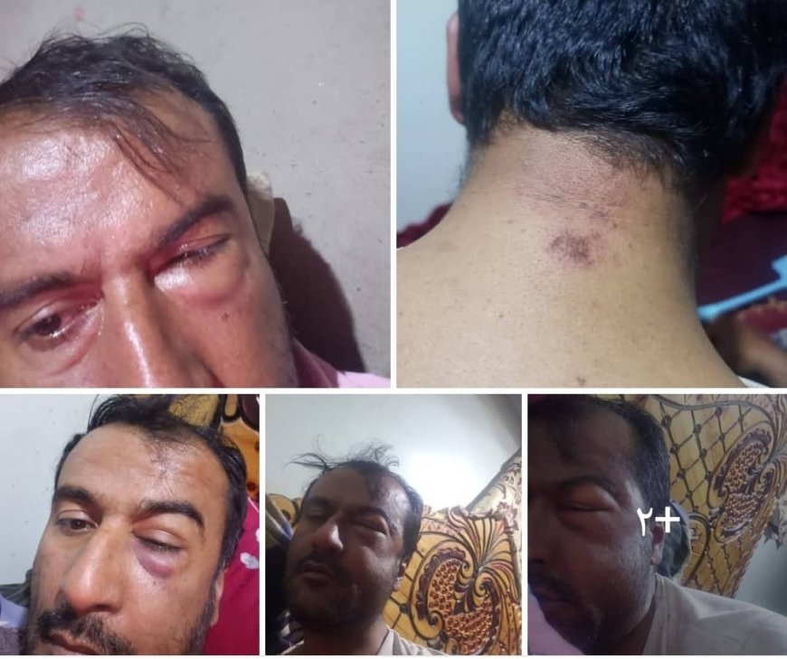 معلم يشكوا تعرضه لاعتداء غادر في الضالع 