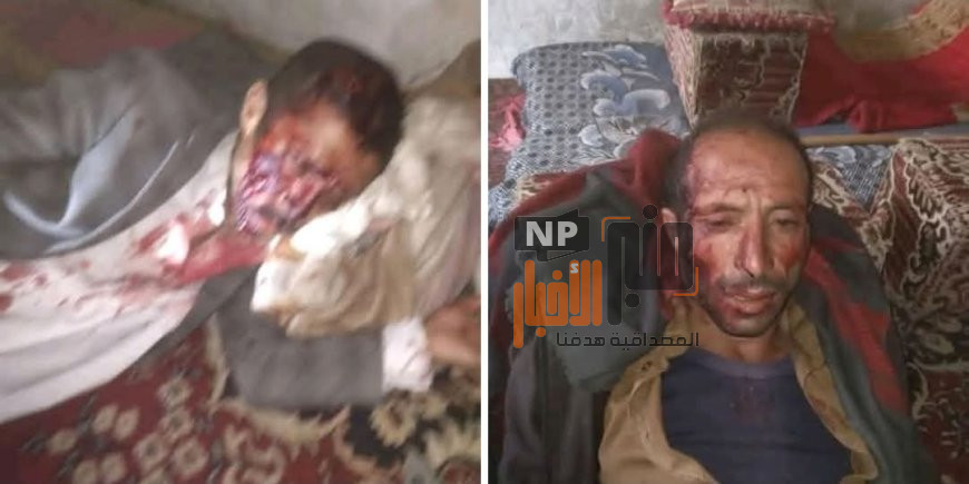 خلال معركة بالفأس..مأساة مؤلمة تهز صنعاء تتسبب بوفيات واصابات (تعرف على تفاصيل الحادثة)