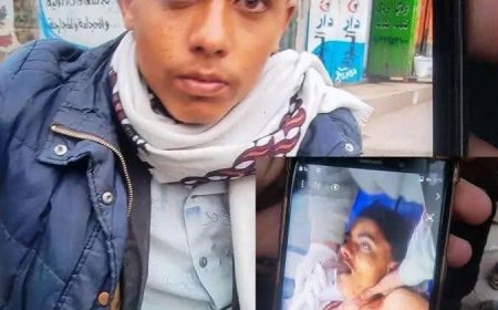 بسبب لا يصدق..جريمة قتل تهز الشارع العام في اب