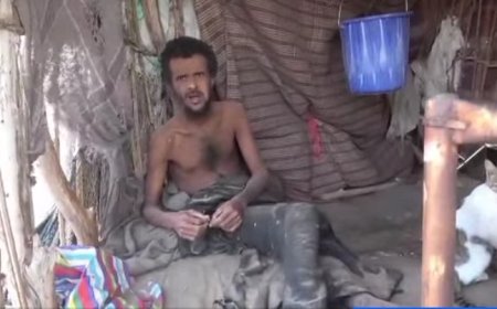 معاق يتيم يعيش مأساة في قرية نائية في المخا ....