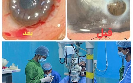 من صنعاء إلى عدن… رحلة أمل تُنقذ عين شابة وتؤكد ريادة الطب التخصصي في مستوصف العين التخصصي