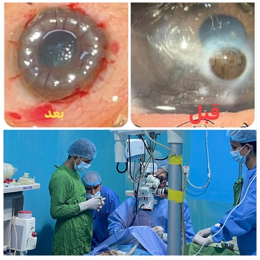 من صنعاء إلى عدن… رحلة أمل تُنقذ عين شابة وتؤكد ريادة الطب التخصصي في مستوصف العين التخصصي