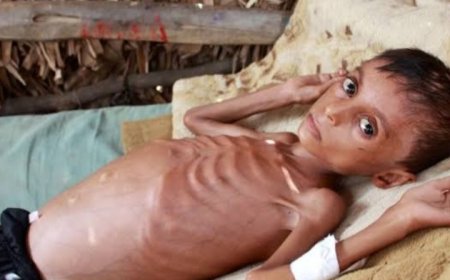 تحذير دولي من مجاعة وشيكة في اليمن ...