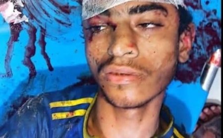  العثور على مصاب في المنصورية جنوب شرق الحديدة في حالة حرجة ...