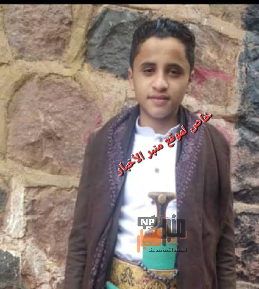 ضمن الحصة البدنية: أثناء تدريبهم على كيفية المواجهات..مقتل طفل خلال حفل مدرسي بسبب استخدام سلاح ناري في اب(تفاصيل حصرية )