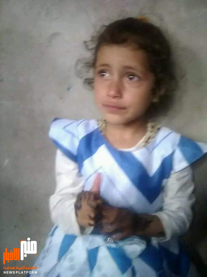 طفلة ضائعة من الضالع موجود في الحبيلين (صورة)