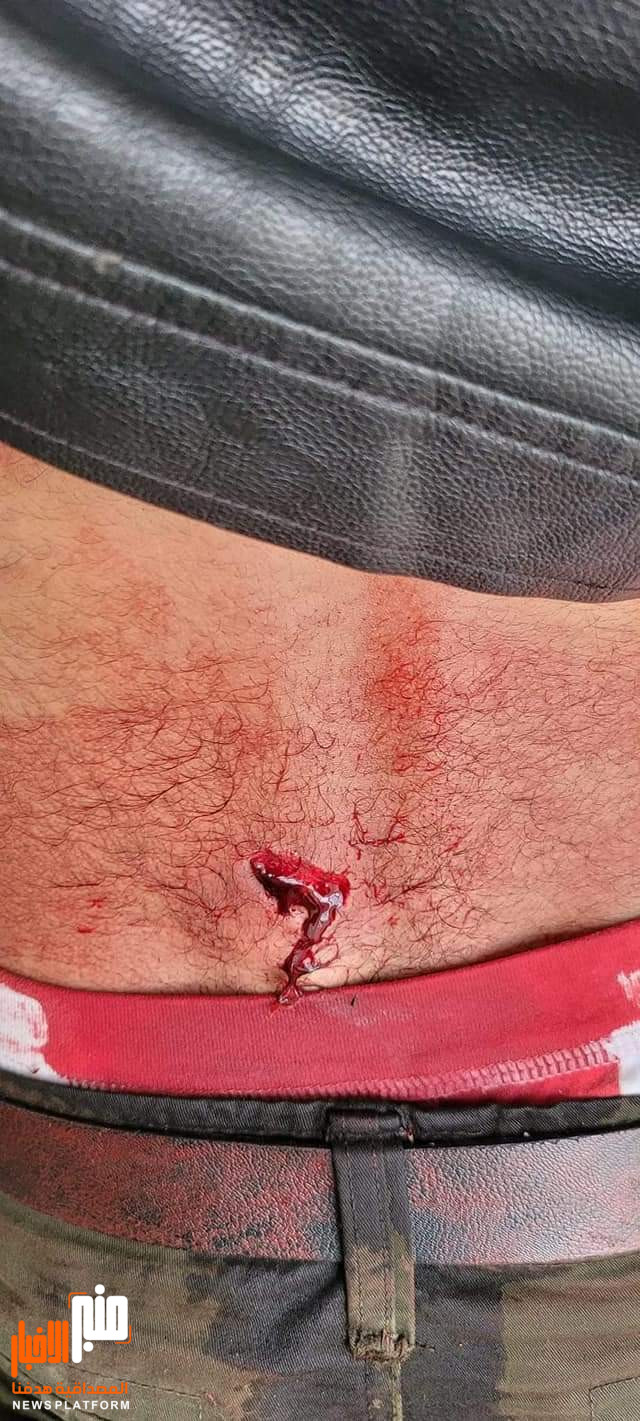 إعتداء يطال الناشط أبو الرجال في صنعاء